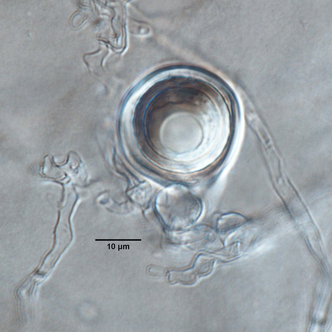   Phytophthora quercetorum  (ex-type CPHST BL 52G) sexual phase: smooth-walled oogonium with comma-shaped tapered base, paragynous antheridium, and aplerotic oospore; photo by Gloria Abad, USDA-APHIS-PPQ. 

